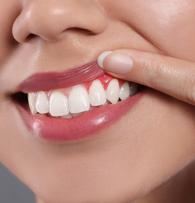 Close-up of person's smile showing white teeth and pink lips, demonstrating dental health.
